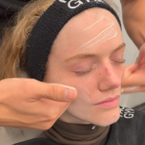 How To Get Rid Of Blemishes