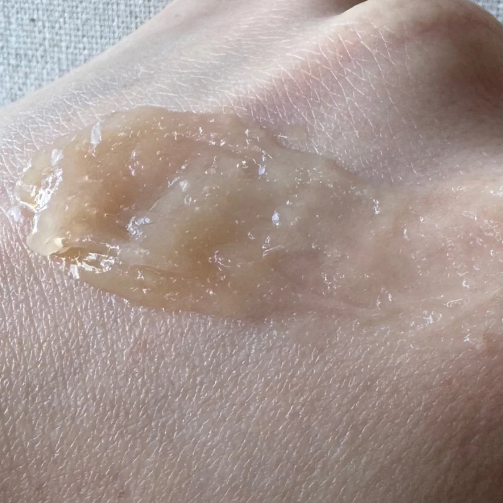 Effects Of Stress On The Skin